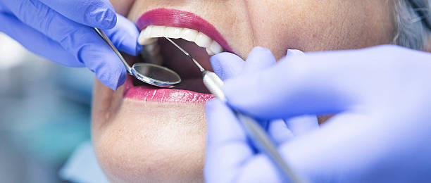 Best Emergency Dental Care for Broken or Chipped Teeth in Genesee, CO